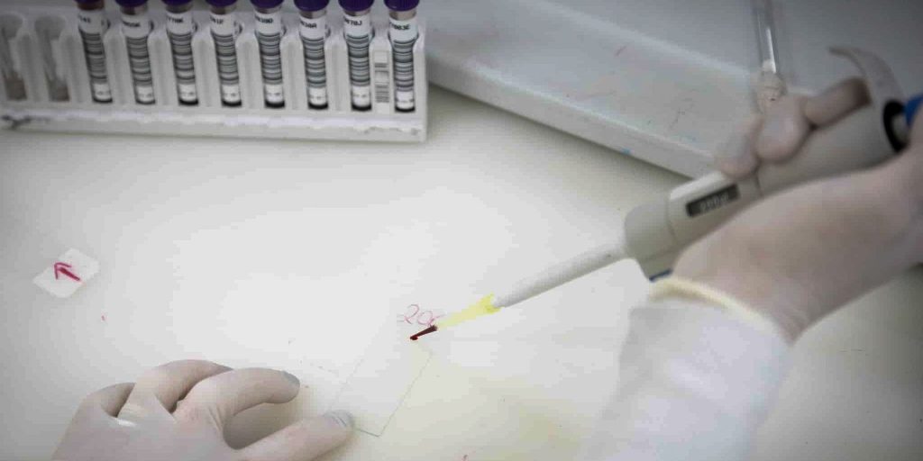 Homem com suspeita de ebola em SP testa positivo para meningite meningocócica