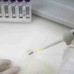 Homem com suspeita de ebola em SP testa positivo para meningite meningocócica
