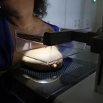 ANS propõe cobertura de mamografia digital sem limite de idade
