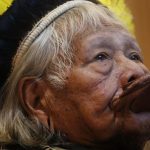 Raoni, 94 anos, enfrenta cirurgia intestinal em SP neste sábado