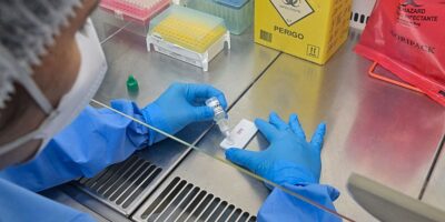 Anvisa atualiza regras e endurece controle em laboratórios