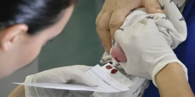Demora no teste do pezinho atrasa diagnóstico e tratamento da AME