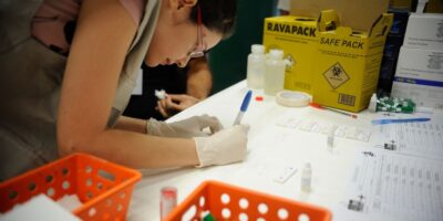 Estudo mapeia hepatites no Brasil com dados de 14,5 milhões