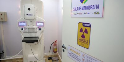 SUS registra alta de 54,3% em cirurgias mamárias entre 2016 e 2025
