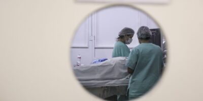Alerta: melanoma também surge em olhos, mucosas e órgãos internos