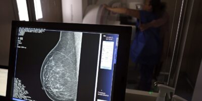 Planos de saúde passam a cobrir mamografia digital para qualquer idade