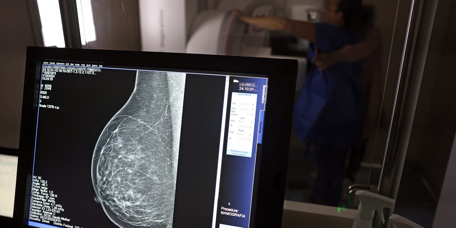 Planos de saúde passam a cobrir mamografia digital para qualquer idade